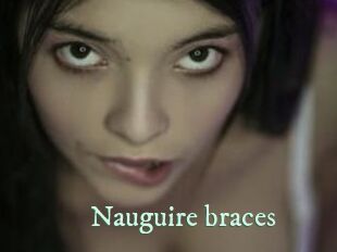 Nauguire_braces